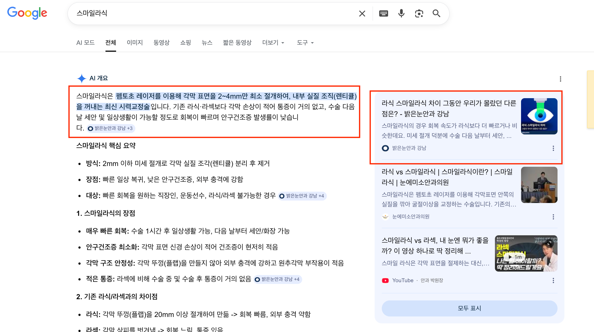 구글 오버뷰 브랜드 노출 예시 — 스마일라식